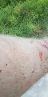 Bild von